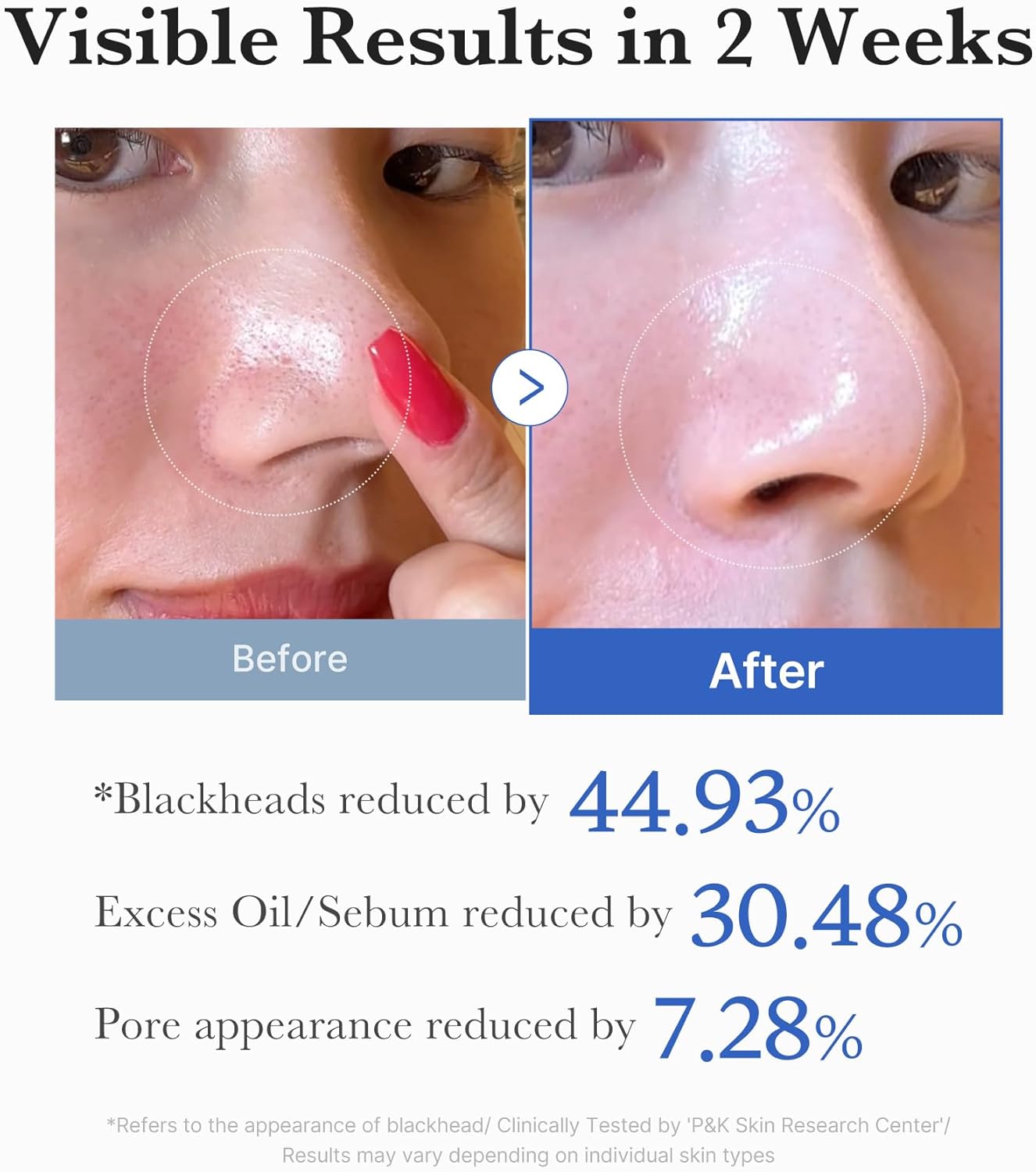 MEDICUBE Zero Pore Pad 2.0 — dvoslojne tonik blazinice za pore
